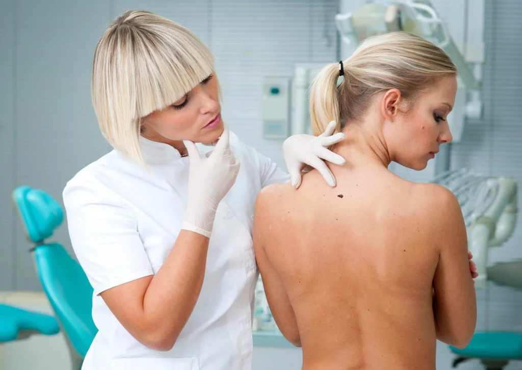 Piegi, plamki, przebarwienia