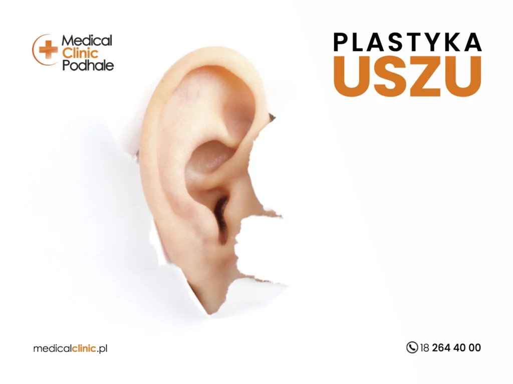 Plastyka uszu – sposób na poprawę wyglądu