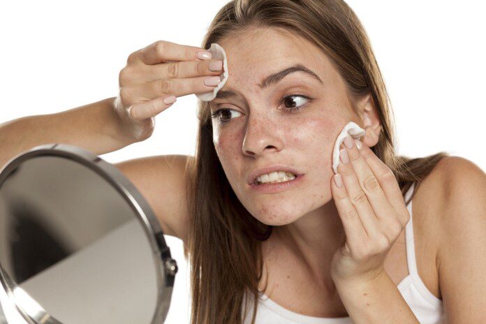 Sebum – czym jest i jak sobie radzić z nadmiernym jego wydzielaniem?