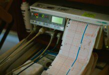 Dlaczego elektrody EKG rozmieszczane są w określony sposób?