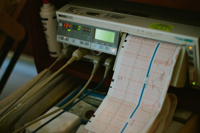 Dlaczego elektrody EKG rozmieszczane są w określony sposób?